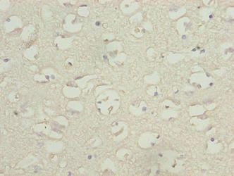 TBC1D14 antibody