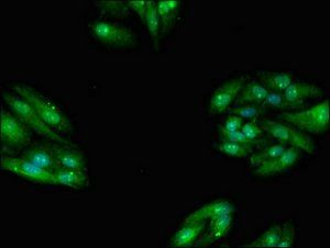 TBC1D15 antibody