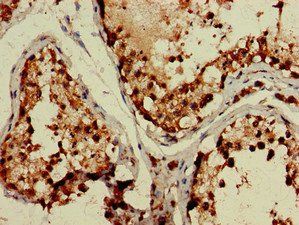 TBC1D15 Antibody
