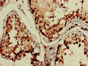 TBC1D15 antibody