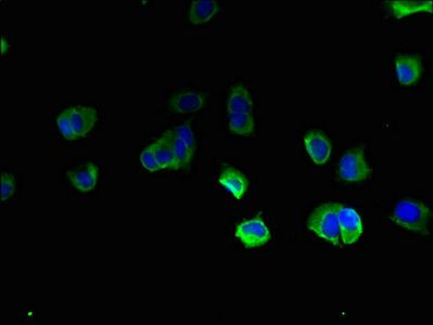 TBC1D20 antibody