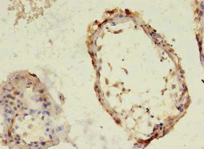 TBC1D20 Antibody
