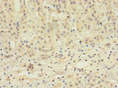 TBC1D20 Antibody