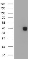 TBC1D21 Antibody