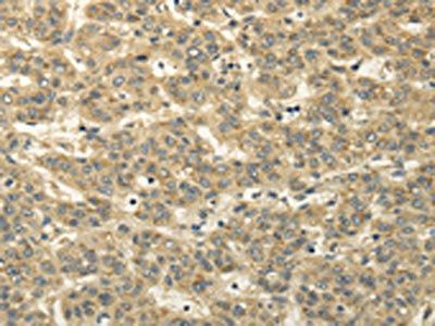 TBC1D22A Antibody