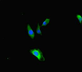 TBC1D24 antibody