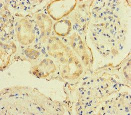 TBC1D24 Antibody