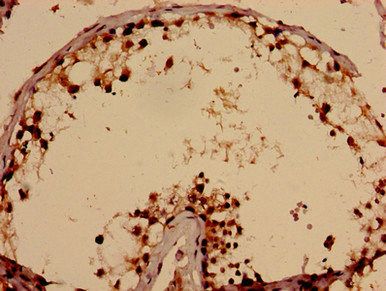 TBC1D31 Antibody