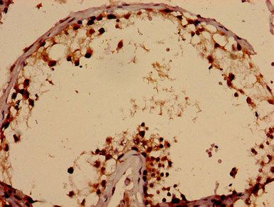 TBC1D31 antibody