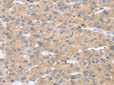 TBC1D4 Antibody