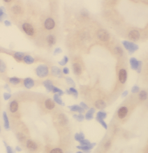 TBC1D5 antibody