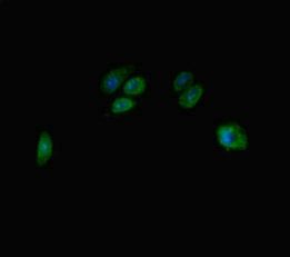 TBC1D7 Antibody
