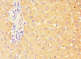 TBC1D7 Antibody