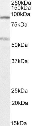 Goat anti-TBC1D9 Antibody