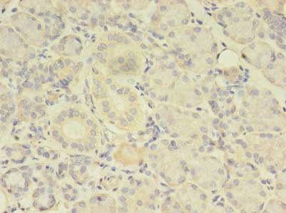 TBCA Antibody