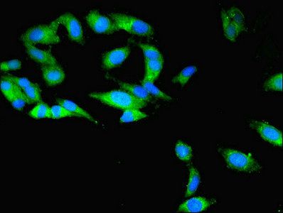 TBCB Antibody