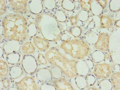TBCB Antibody