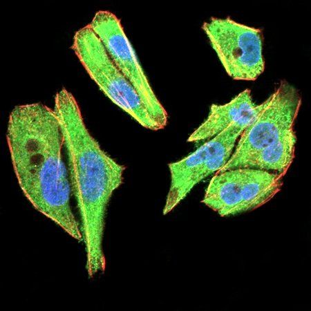 TBCC Antibody