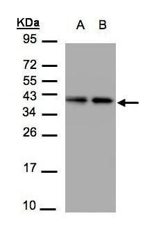 TBCC antibody