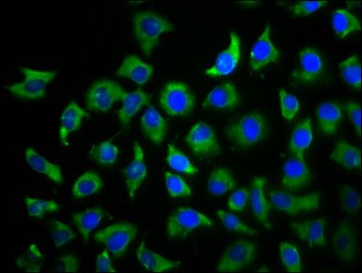 TBCD Antibody