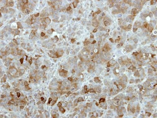 TBCK antibody [C1C2], Internal