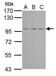 TBCK antibody [C1C2], Internal