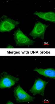 TBG Rabbit Polyclonal Antibody