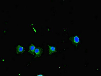 TBK1 Antibody