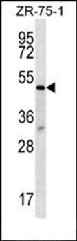 TBL2 antibody
