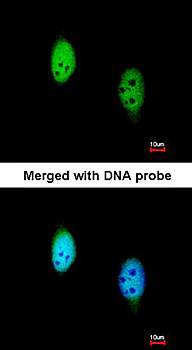 TBLR1 Rabbit Polyclonal Antibody