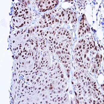 TBLR1 Rabbit Polyclonal Antibody