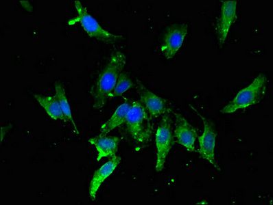 TBP Antibody