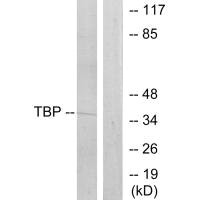 TBP Antibody