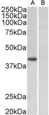 Goat anti-TBP /Transcription factor IID (aa39-50) Antibody