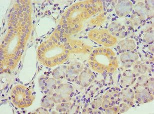TBRG1 Antibody