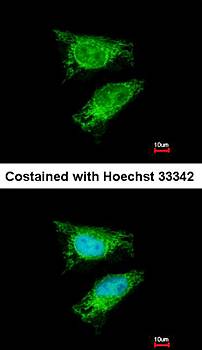 TBRG4 Rabbit Polyclonal Antibody
