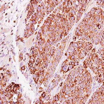 TBRG4 Rabbit Polyclonal Antibody