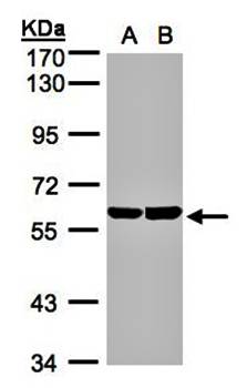 TBRG4 Rabbit Polyclonal Antibody