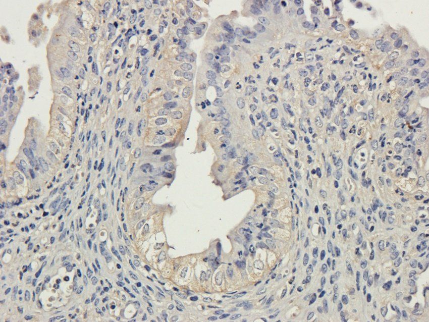 TBX1 antibody