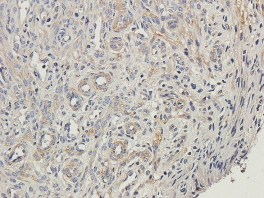 TBX1 antibody