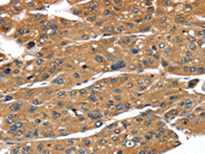 TBX10 Antibody