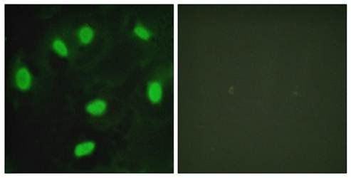 TBX15/18 antibody