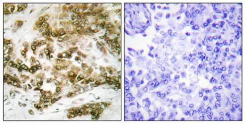 TBX15/18 antibody