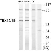 TBX15 antibody