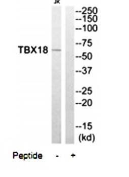 TBX18 Antibody