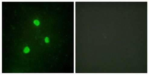 TBX1 Antibody