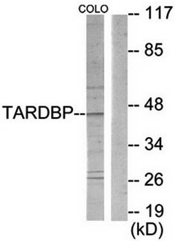 TBX1 Antibody