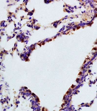 TBX2 Rabbit Polyclonal Antibody