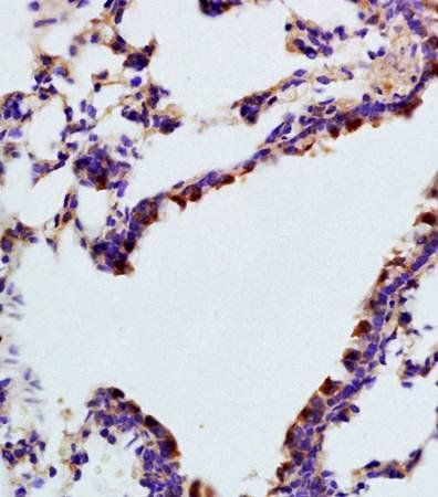 TBX2 antibody