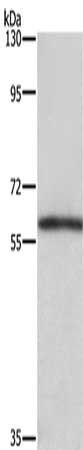 TBX5 Antibody